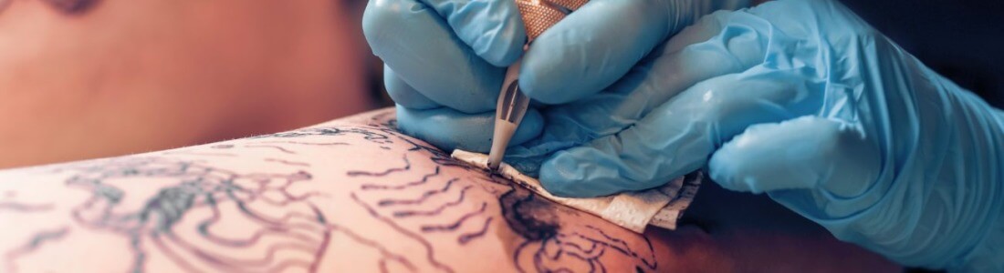 Tattooing like this can trigger CRPS in susceptible people