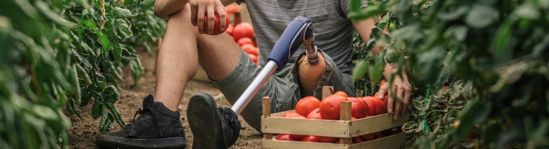 Man with prosthetic limb following amputation for CRPS