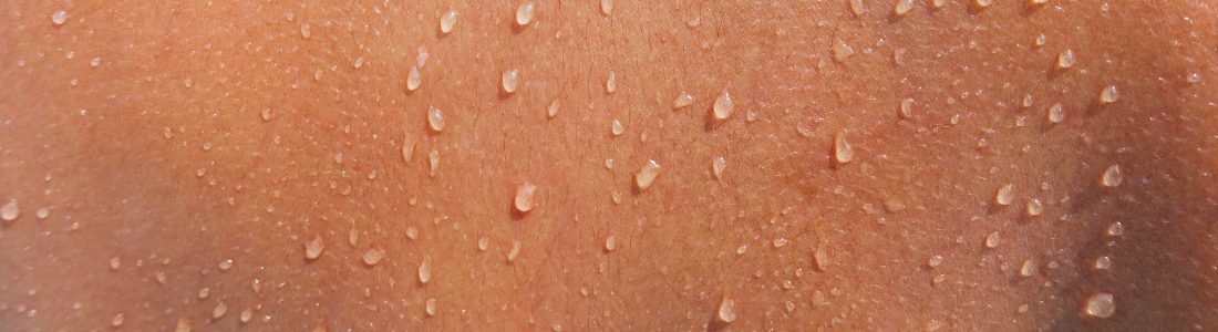 Person with CRPS sweating