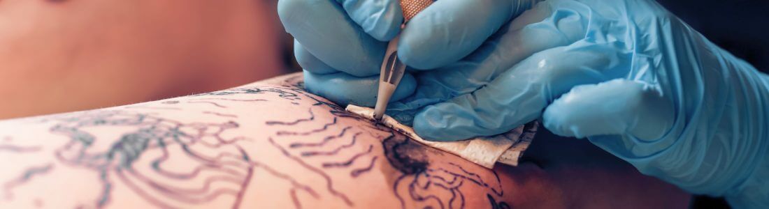 Tattoos like this can trigger CRPS in susceptible people